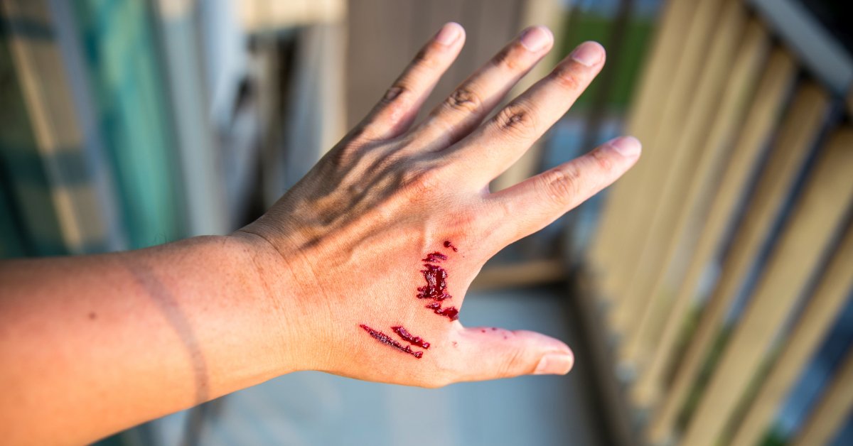 hand cut bitten